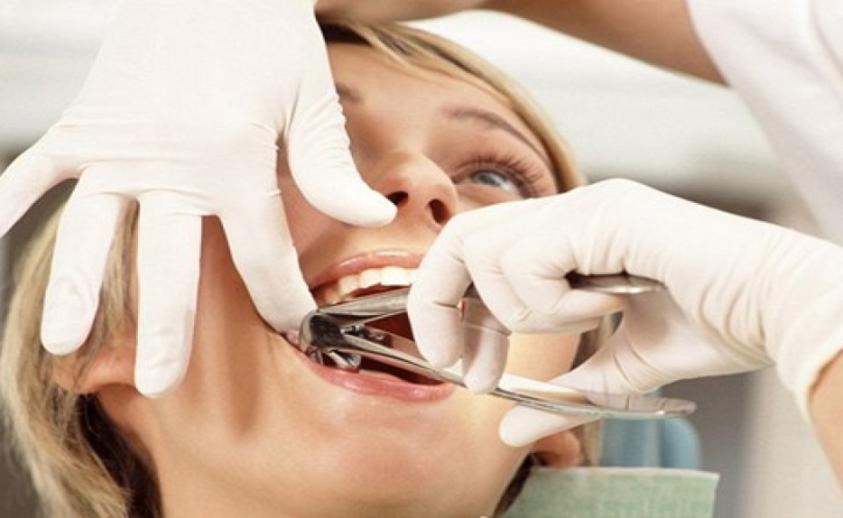Хирургическая стоматология зубов. Когда в марте удалять зубы